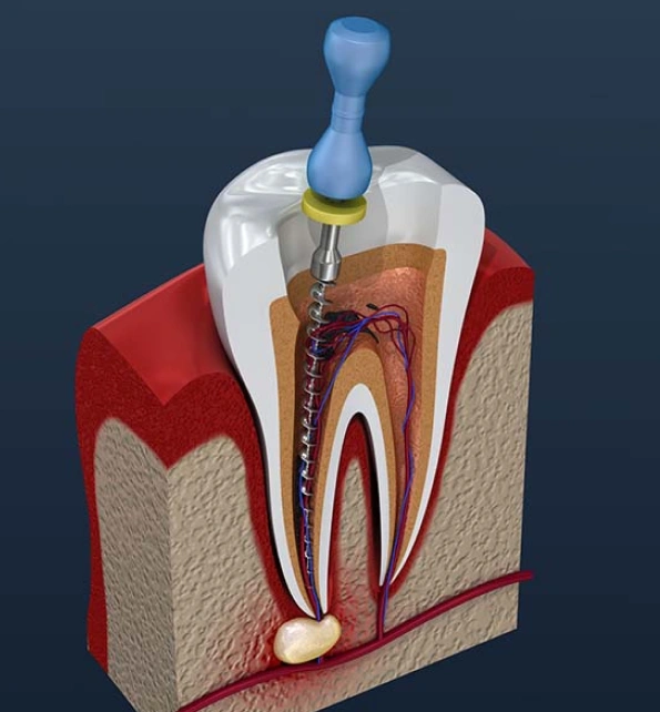 Charlotte Pediatric Dentist