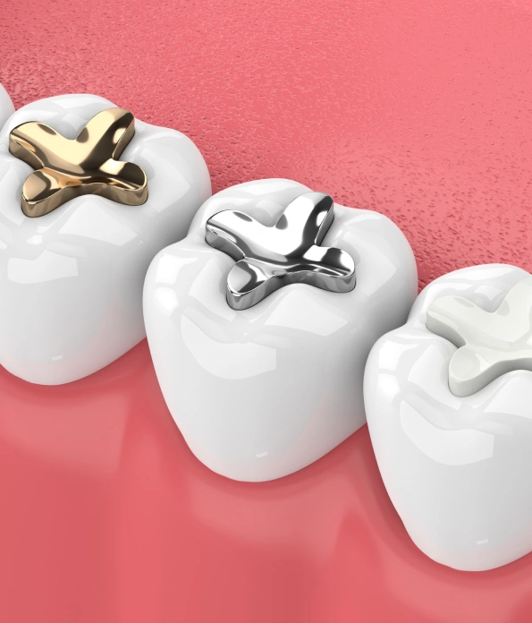 Restorative Pediatric dentist Charlotte