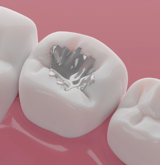 Dental Fillings in Rocklin, CA