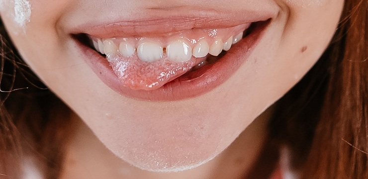 Dental Crowns - beautiful female smile with tongue out