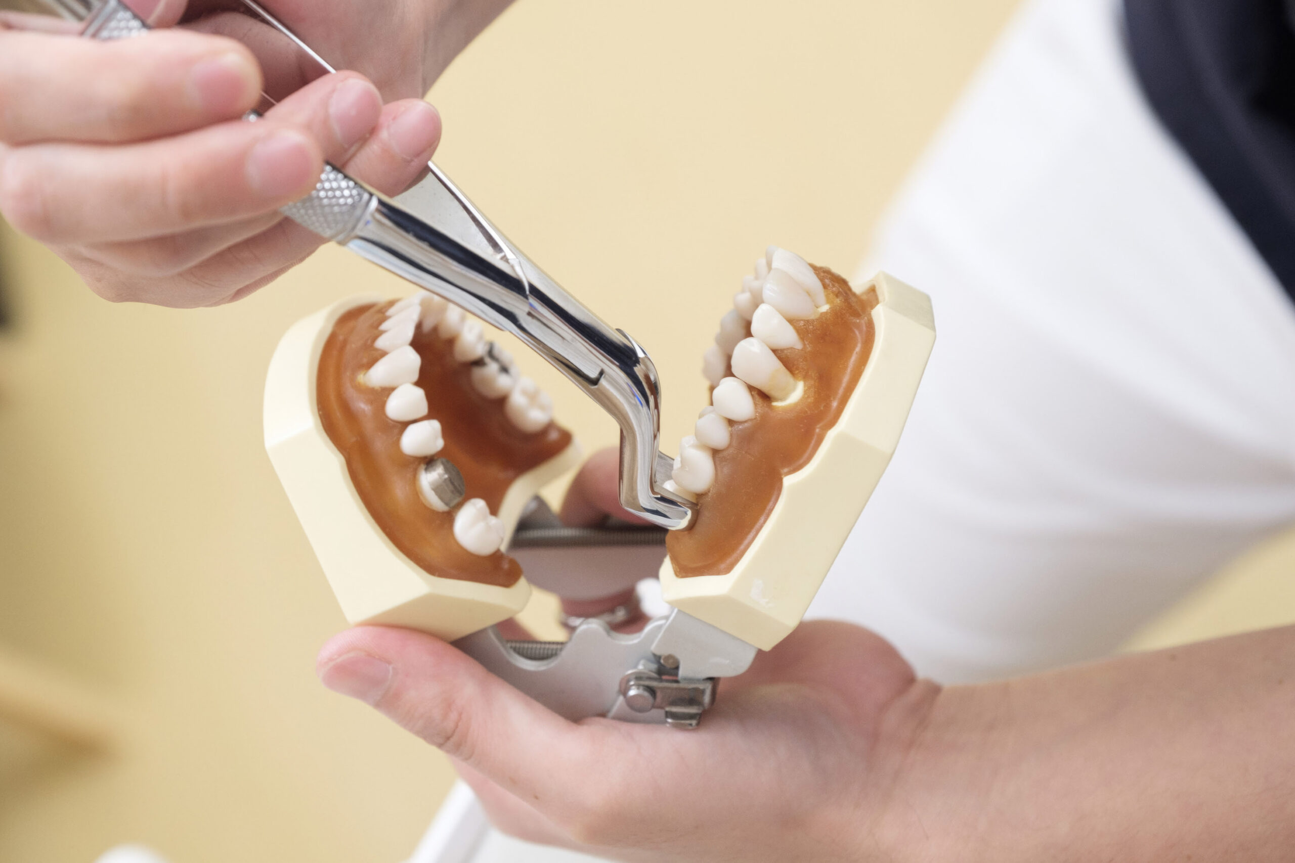 Heal After an Extraction? Dr. Purna Patel’s Guide