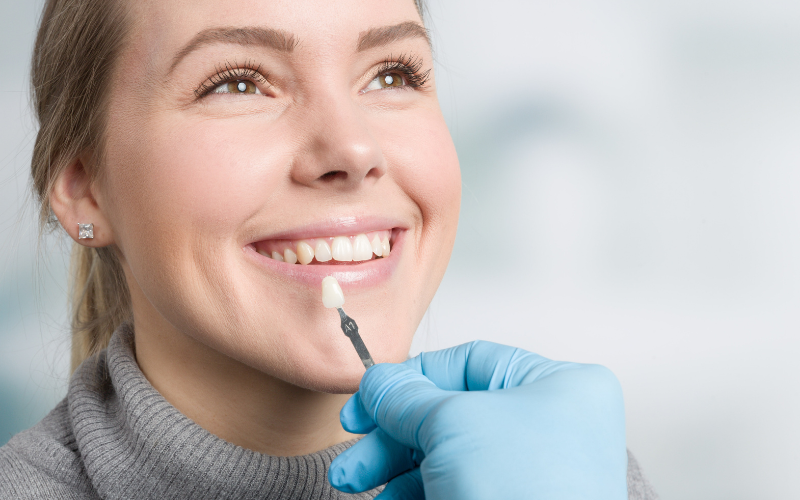 Exclusive Veneer offers