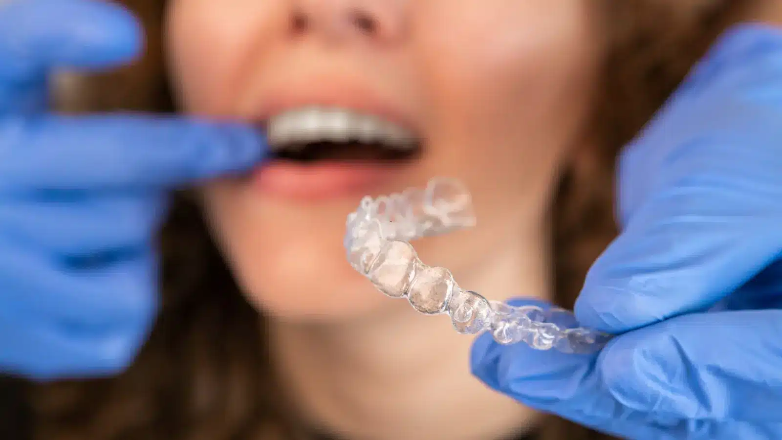 Your Invisalign Provider