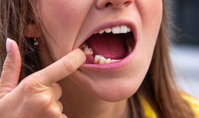 tips for saving a knocked-out tooth