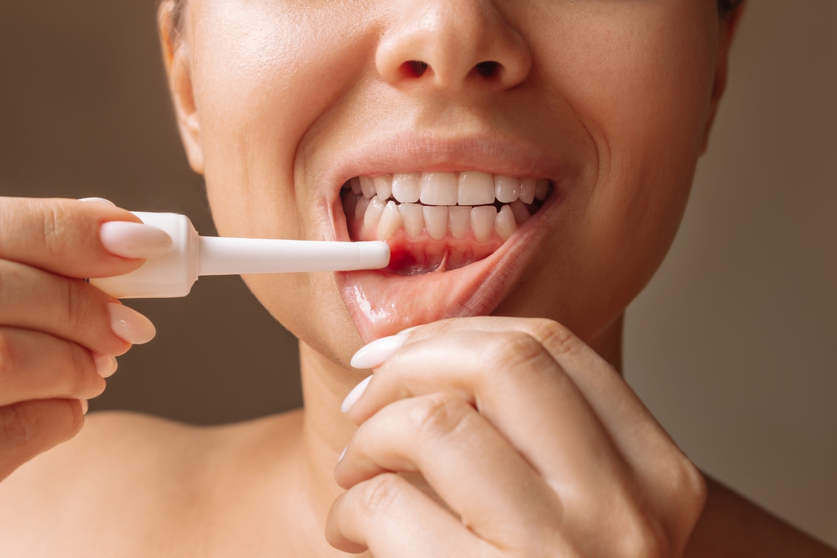 Bleeding Gums After Brushing