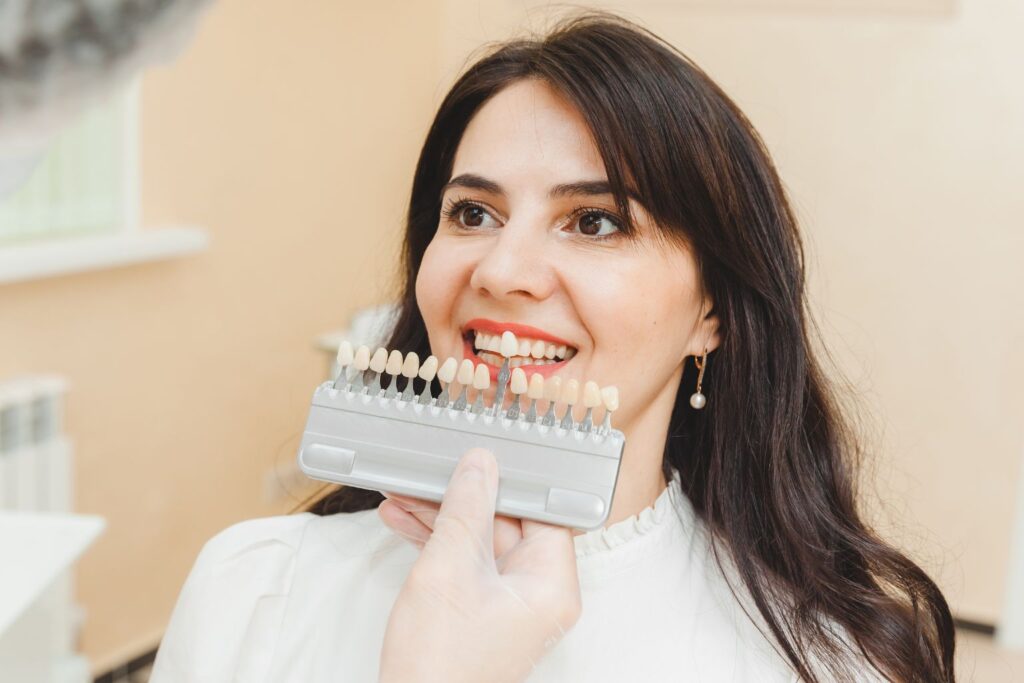what are veneers