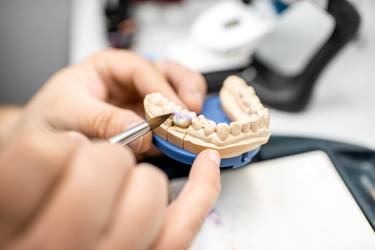 Dental Crowns in Rockaway