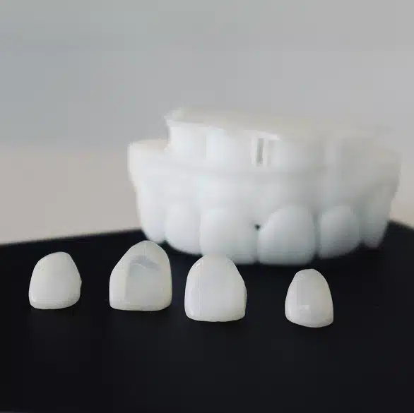 Enhance Your Smile with Porcelain Veneers
