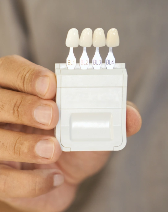 Dentist holding a porcelain veneer shade guide for smile makeover consultation