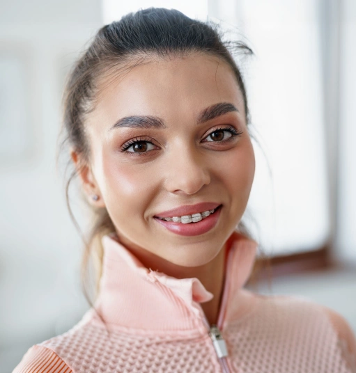 Clear Braces