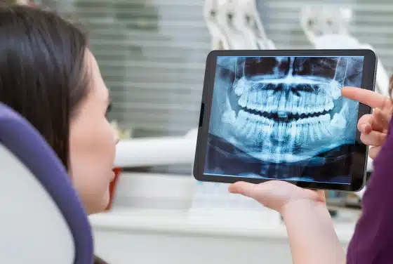 Digital X-Rays
