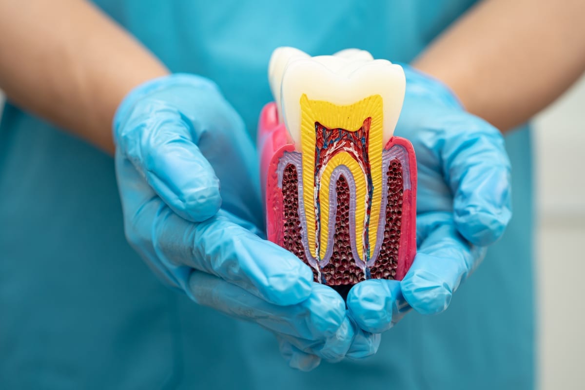 Root Canal Treatment in Middletown