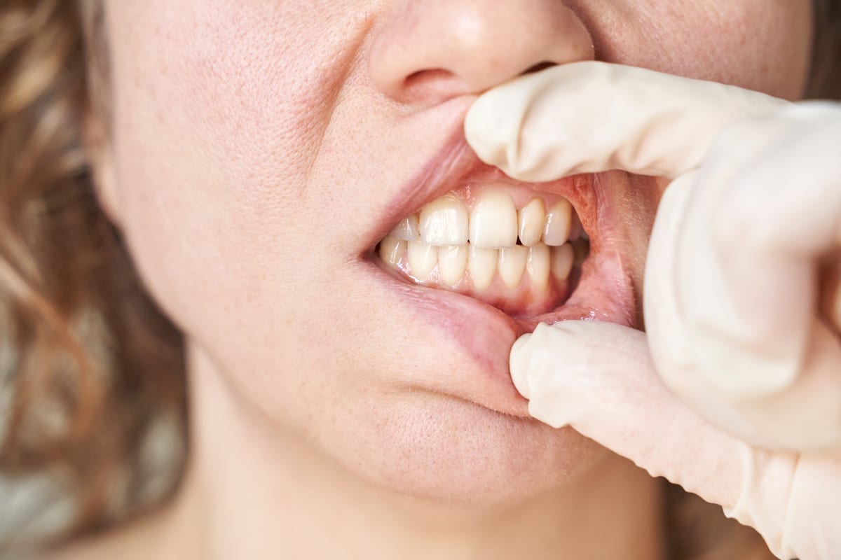 Periodontal Care in Scotchtown
