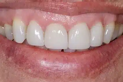 get a perfect smile from Dentist Arcadia - before
