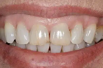 get a perfect smile from Dentist Arcadia - before