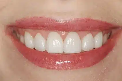healthier smile by dentist arcadia - After
