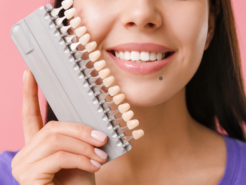 what glue do dentists use for veneers