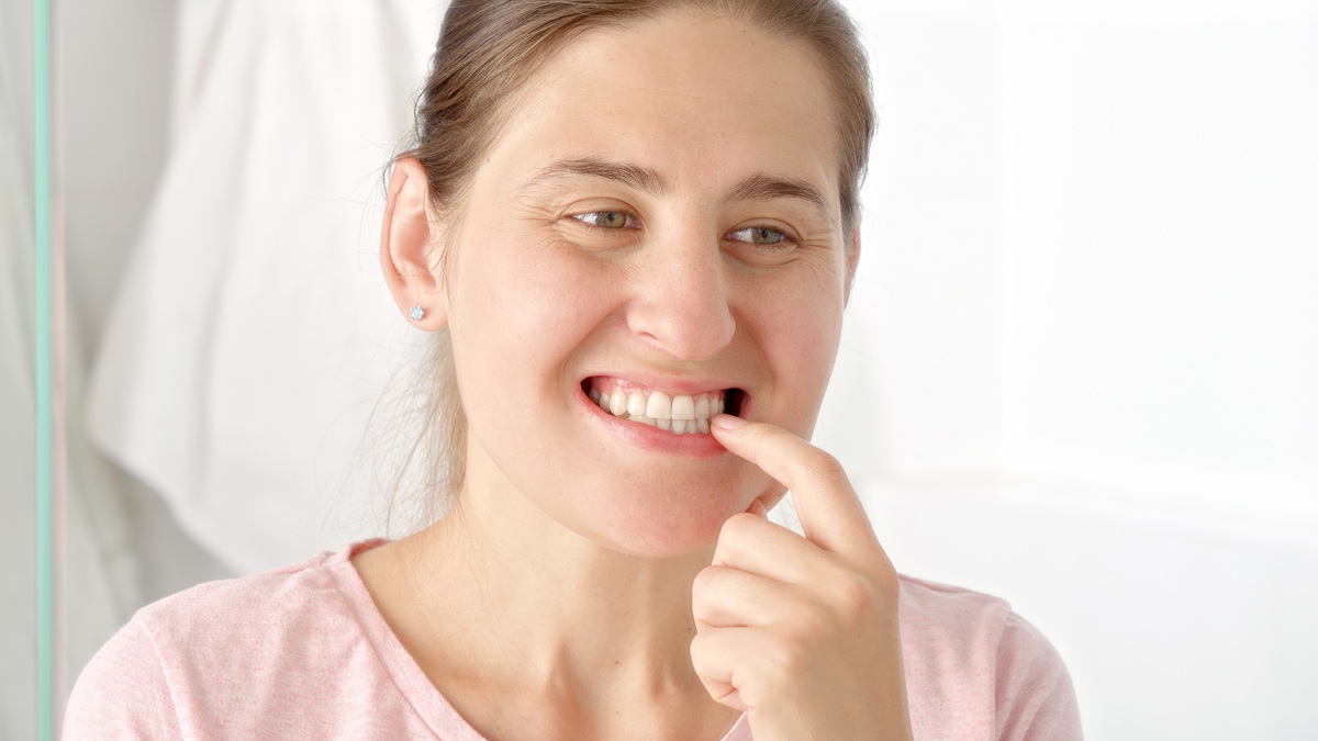 Yellow teeth after brushing showing enamel discoloration