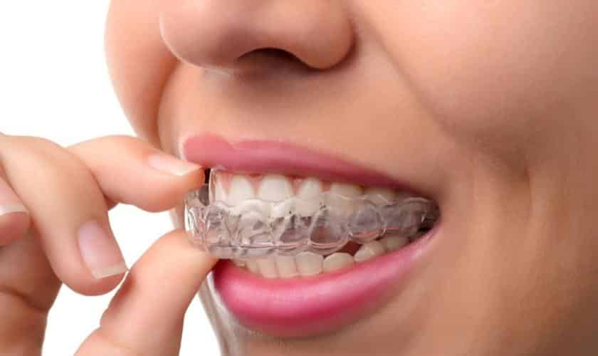 Invisalign dentist denver