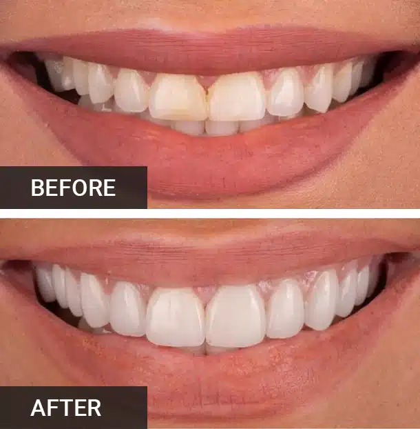 Preventive Dentistry in Aurora