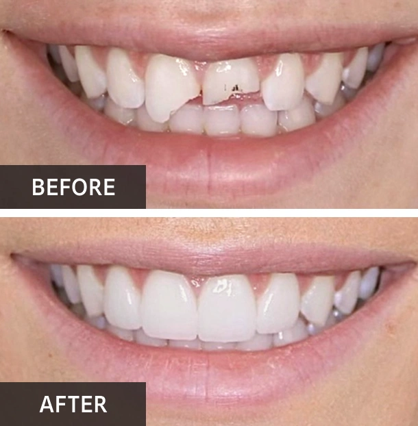 Restorative Dentistry in Glendale