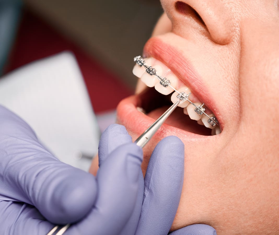 Restorative Dentistry in Glendale