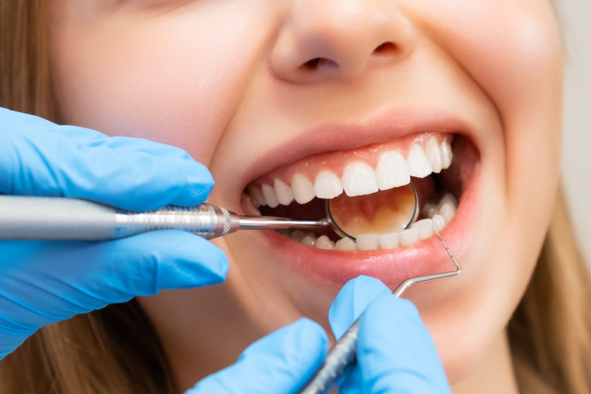 Gum Disease Treatment in Denver