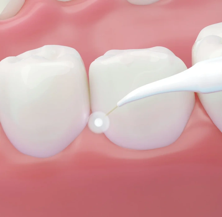 A Modern Approach to Healthier Gums