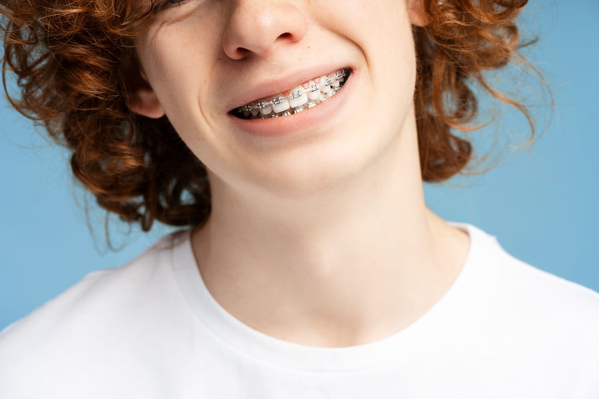 Orthodontics in Smyrna