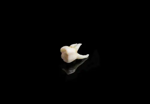 Best Aftercare Tips Following a Tooth Extraction