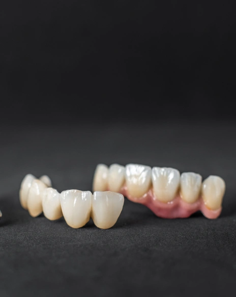 A row of permanent ceramic dental crowns and bridge restorations displayed on a dark surface.