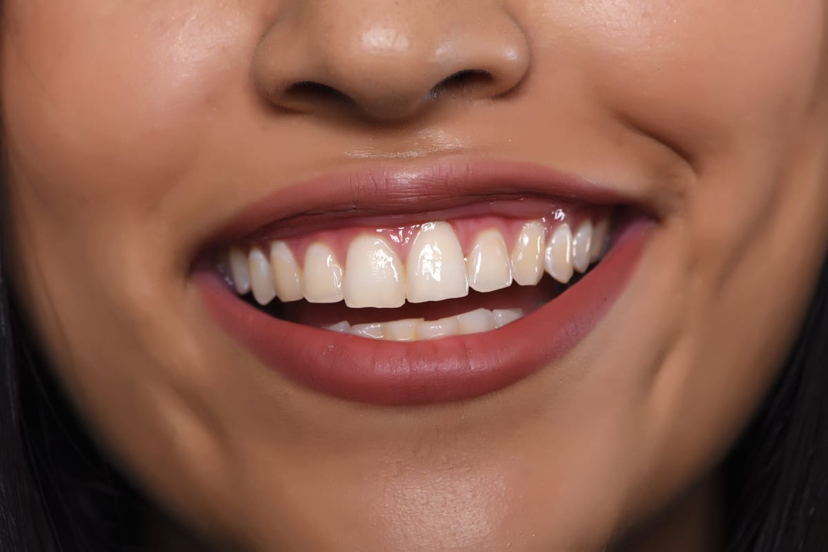 Gum Disease Treatment in Bethel Park