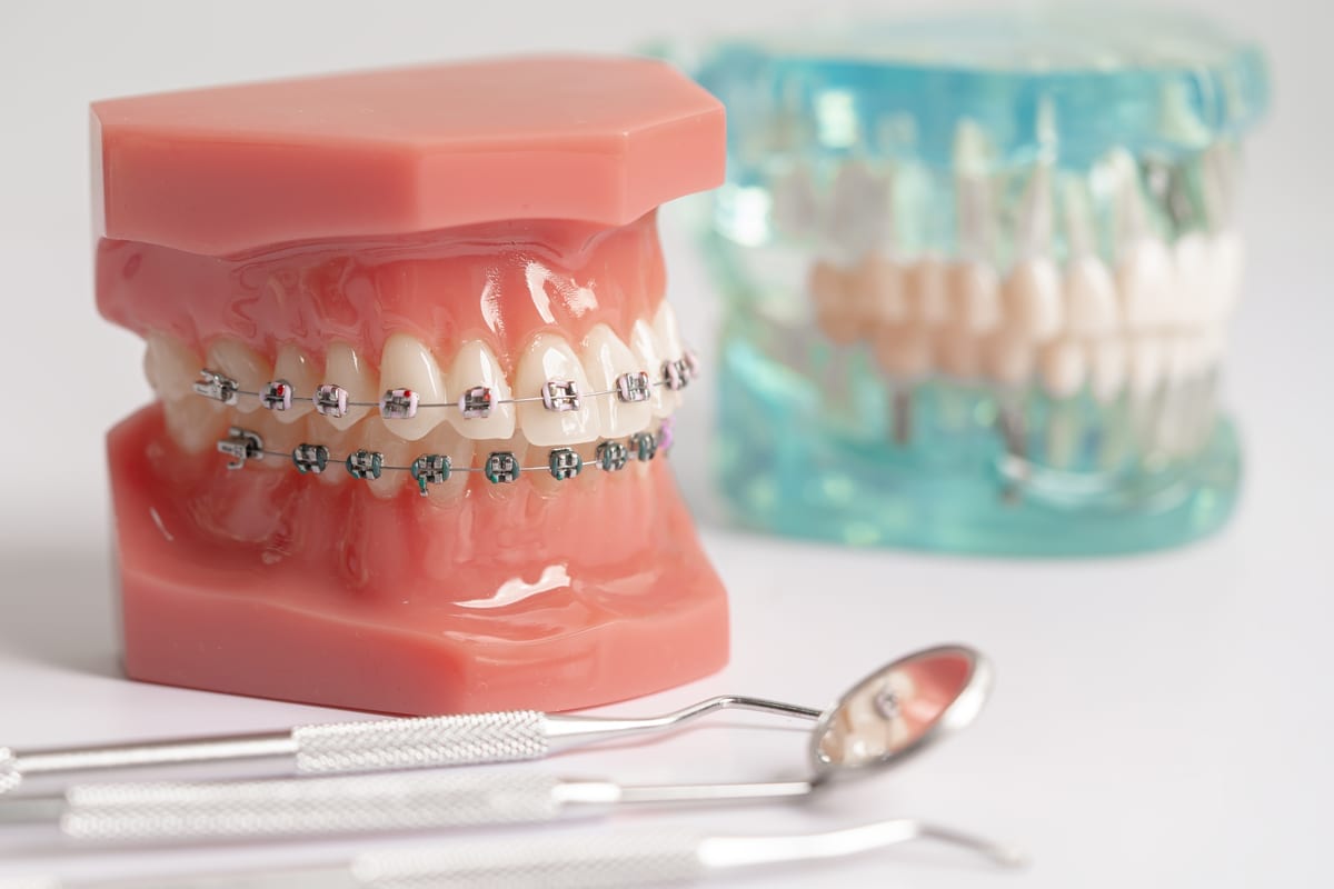 Braces in Sewickley