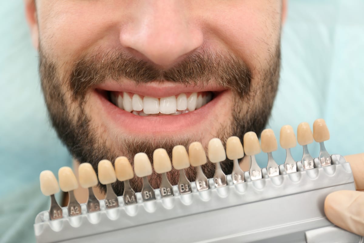 Veneers in Sewickley