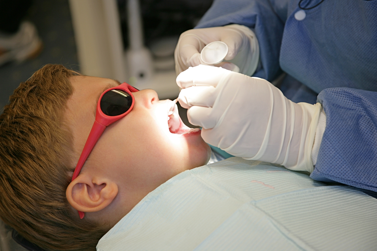 fluoride-treatment-in-Spanaway