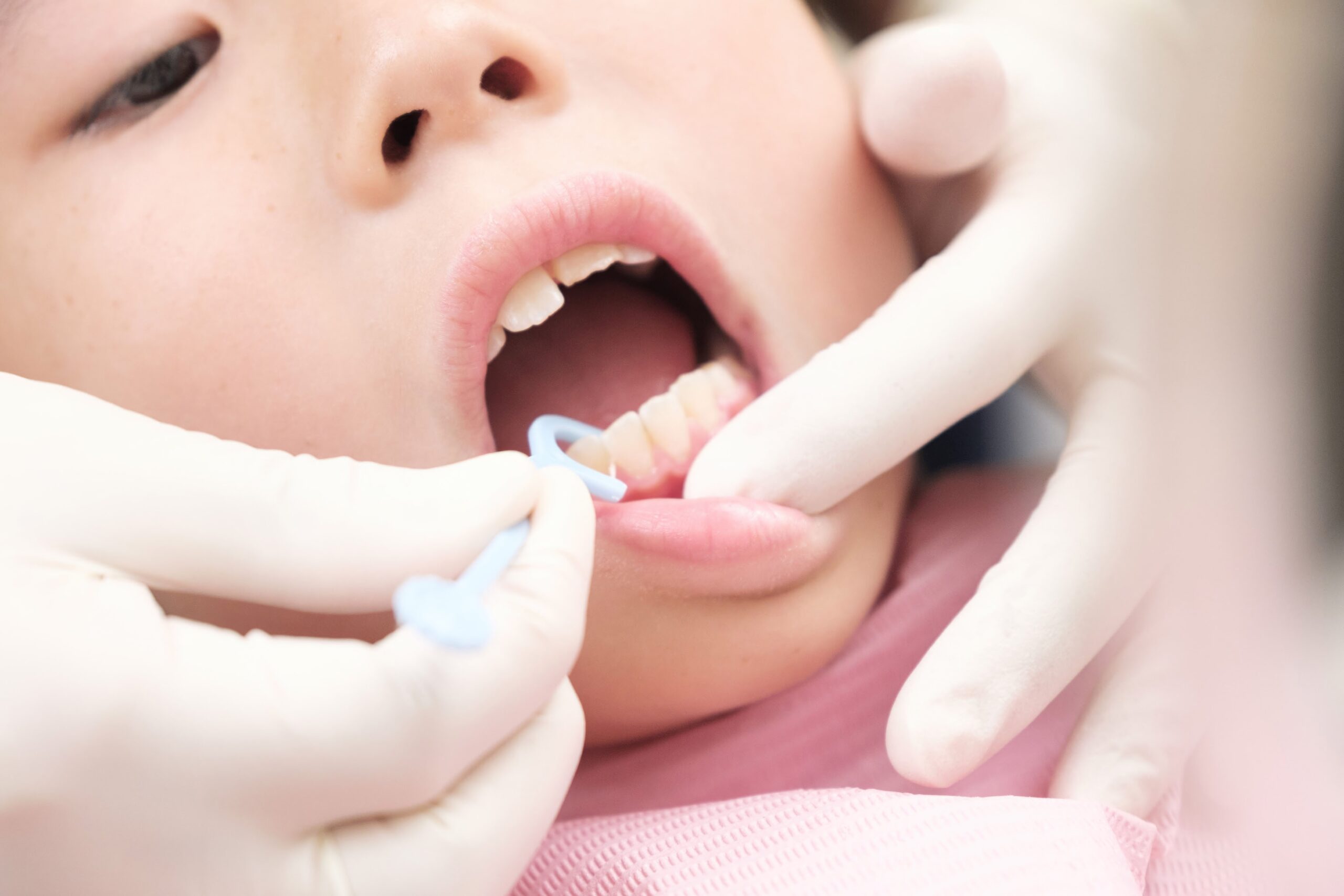 Children's dental health checkup