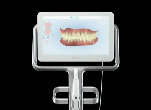 img-technology-iTero Scanner