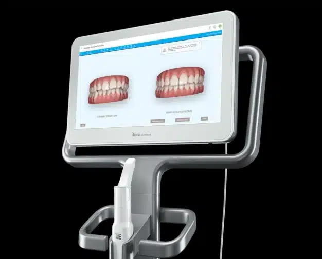 img-all-about-retainers-Why-Do-I-Need-a-Retainer