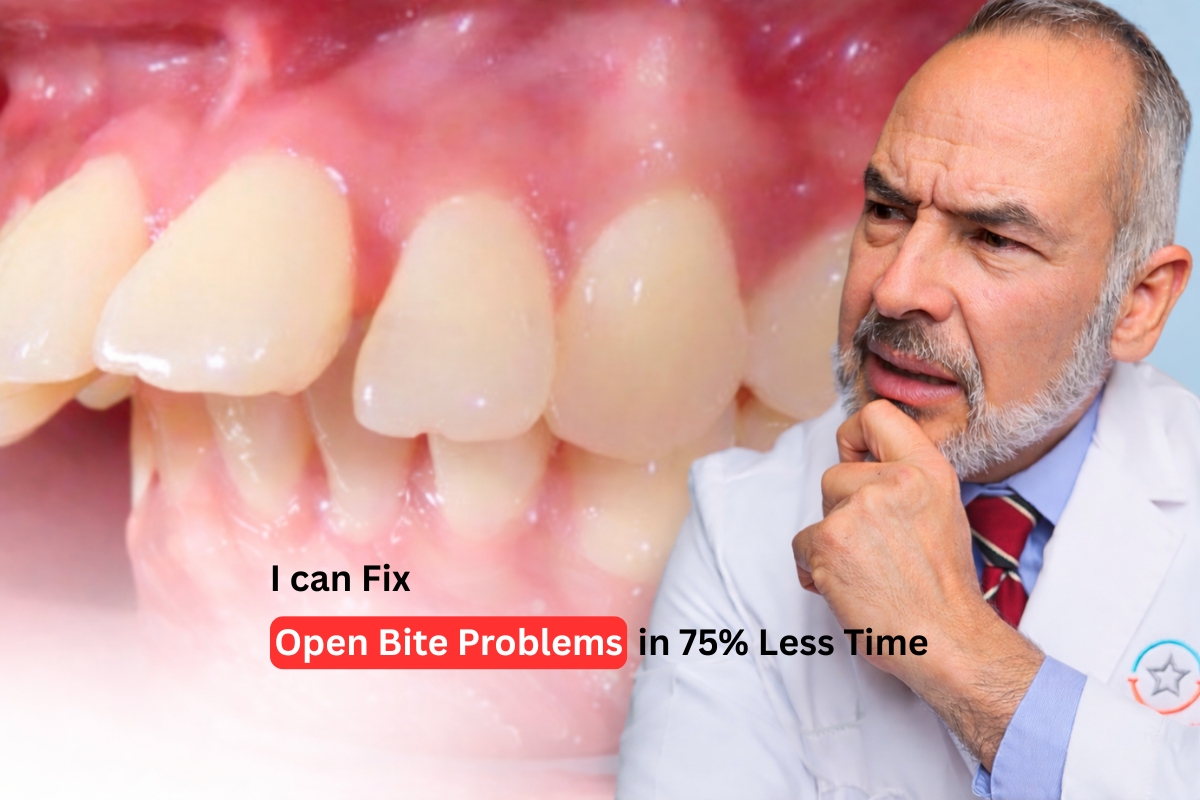 Braces treatment for open bite in Grapevine TX