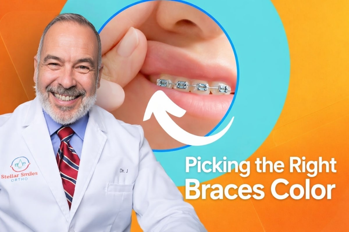 Dr. J Theodorou explains how to pick the right braces color