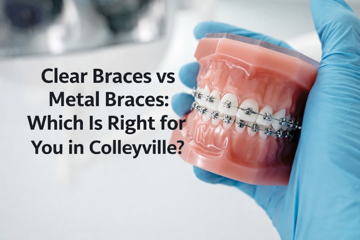 clear braces vs metal braces colleyville tx