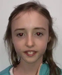 Leanna — Antes