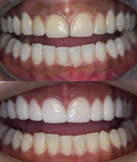 Before & After