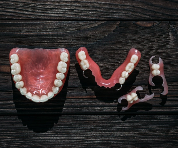 Partial dentures at Stuyvesant Dental in Manhattan, NYC, replacing multiple missing teeth with a natural fit.