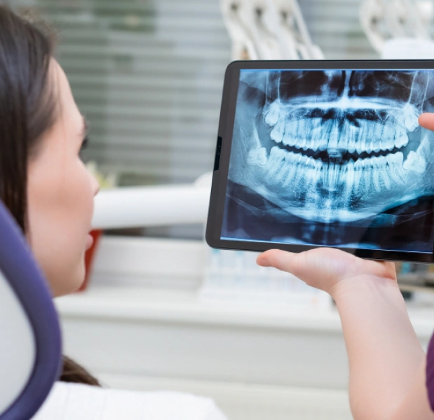 Digital X-ray imaging in Manhattan, NYC at Stuyvesant Dental, capturing detailed views of teeth and jaw with low radiation.