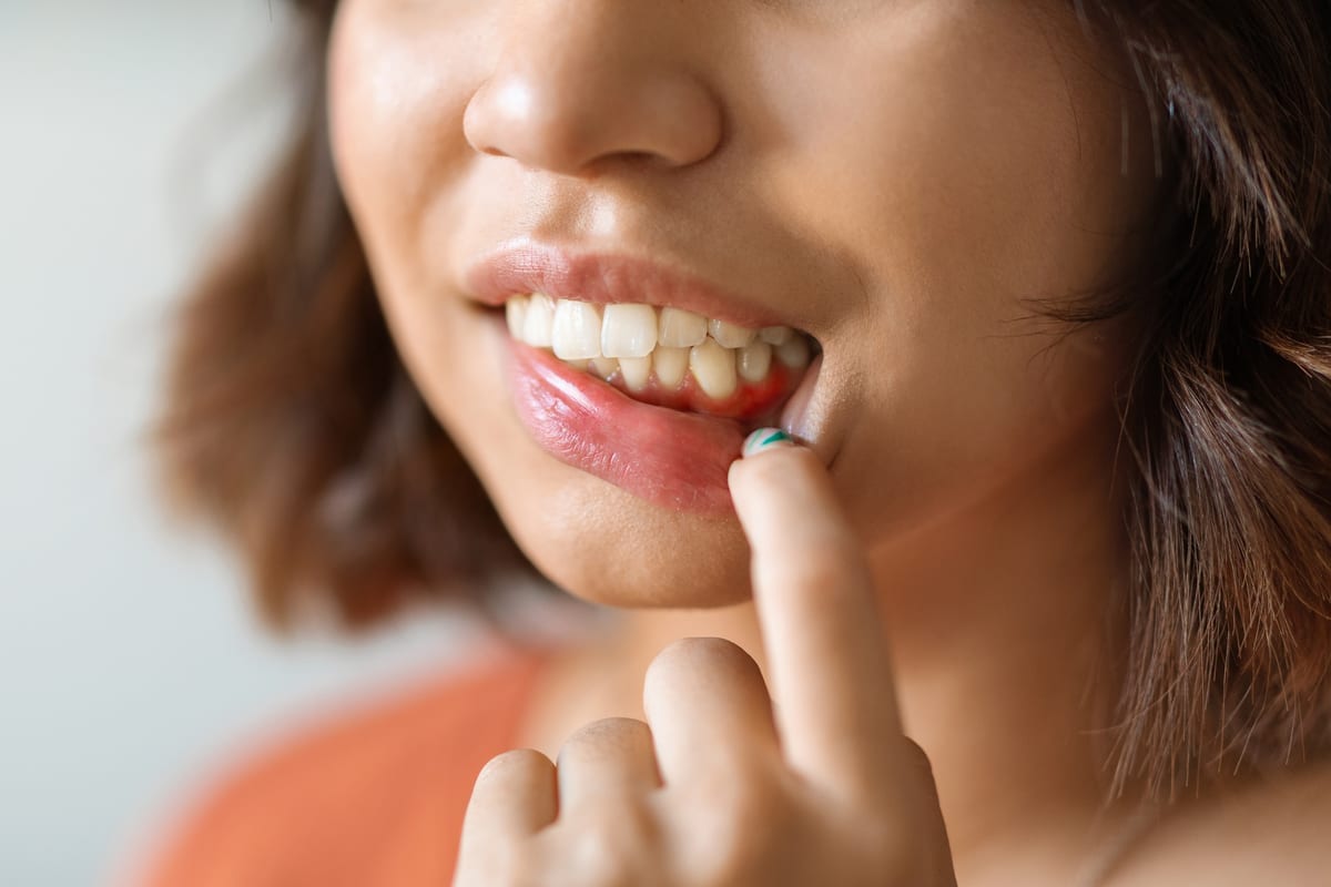 Periodontal Care in Fountain Valley