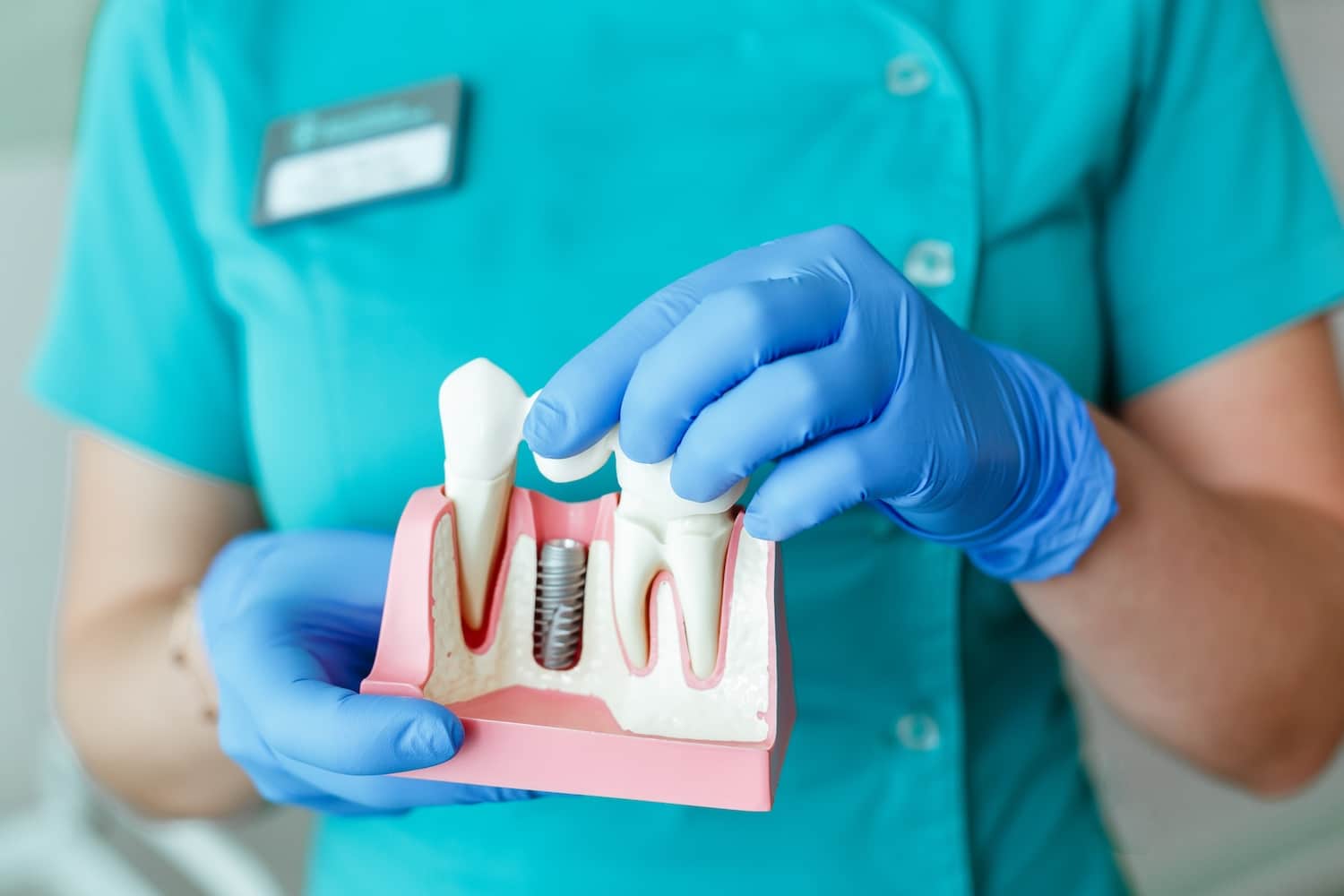 learn about molar implants