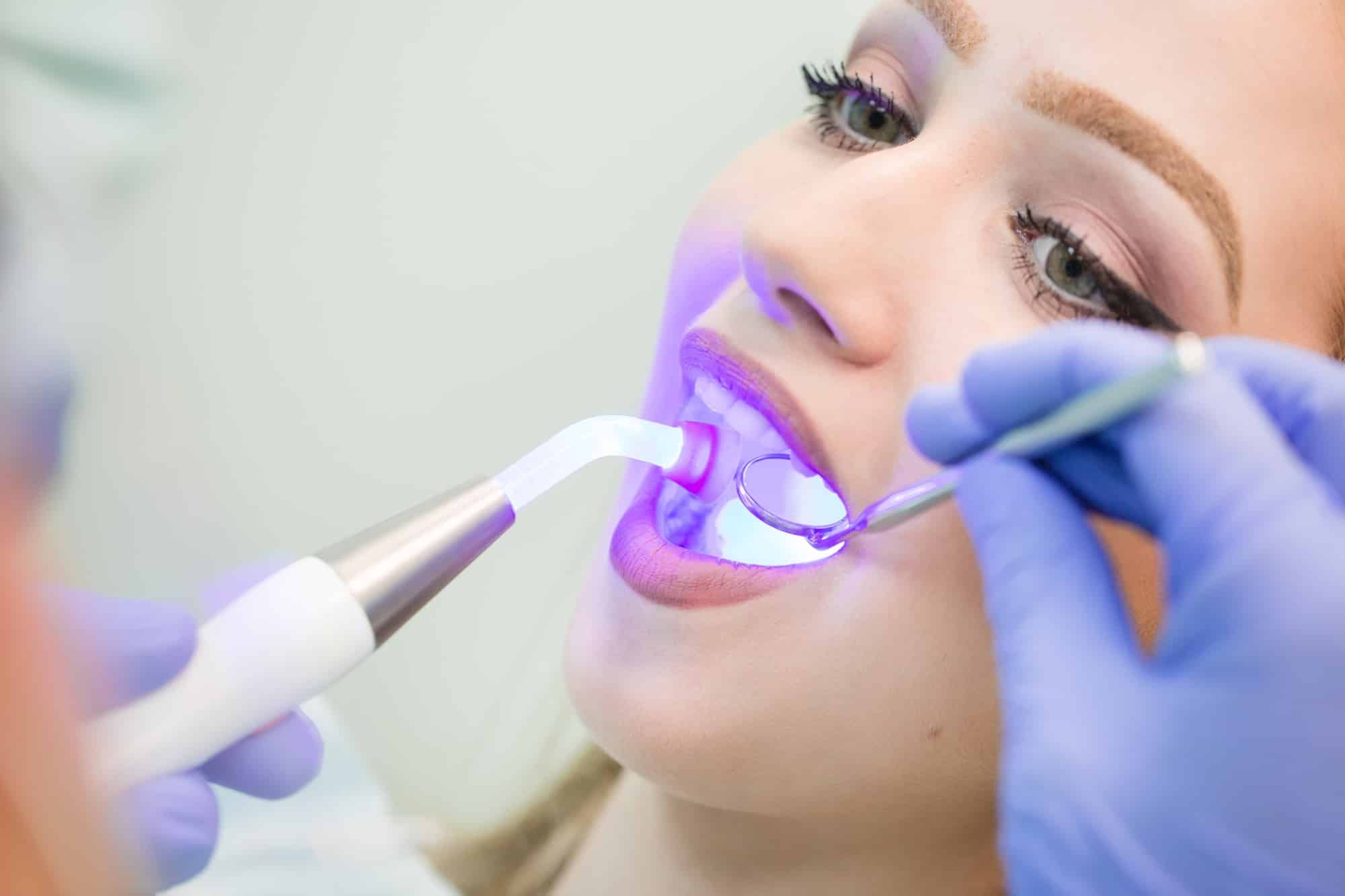 does tooth dental bonding hurt