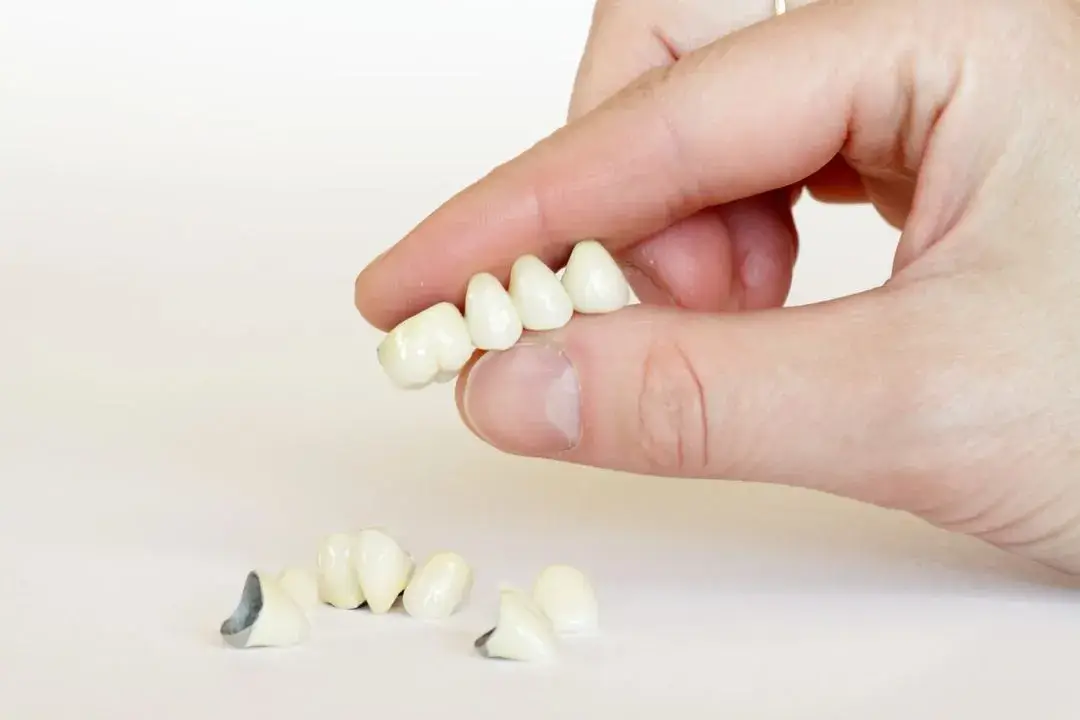 Dentist Holding a Bridge and Crown at Thrive Family Dentistry in Auburn
