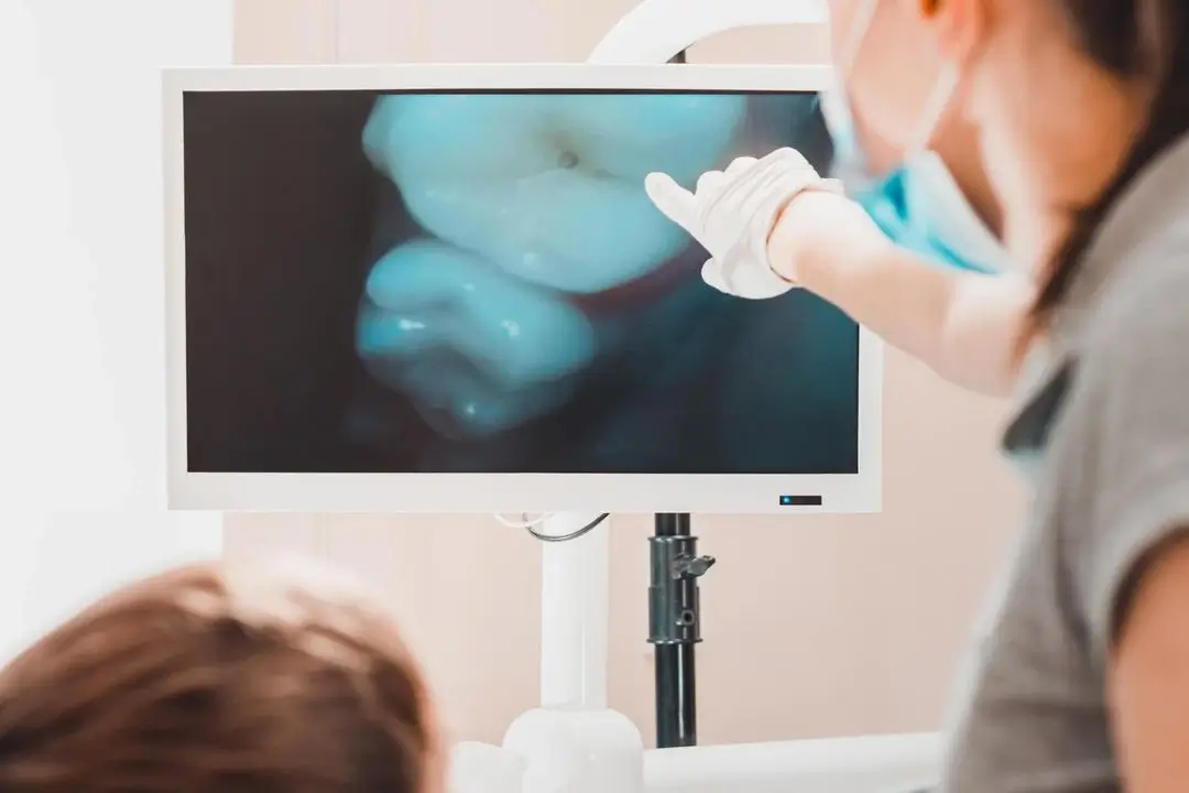dentist explaining Tooth Fillings Auburn AL to patient